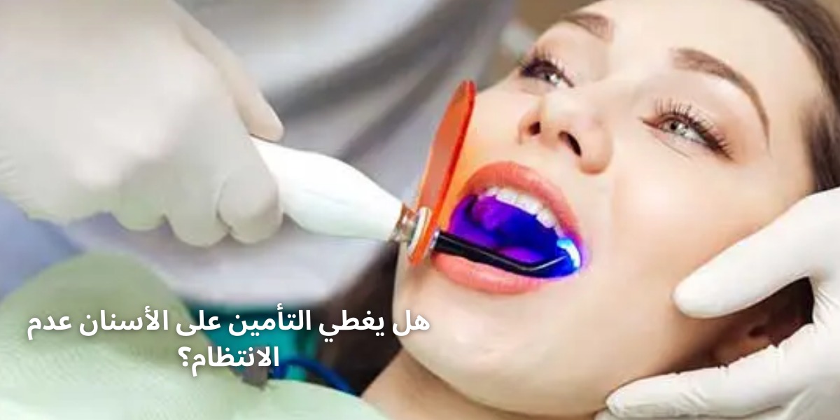 هل يغطي التأمين على الأسنان عدم الانتظام؟